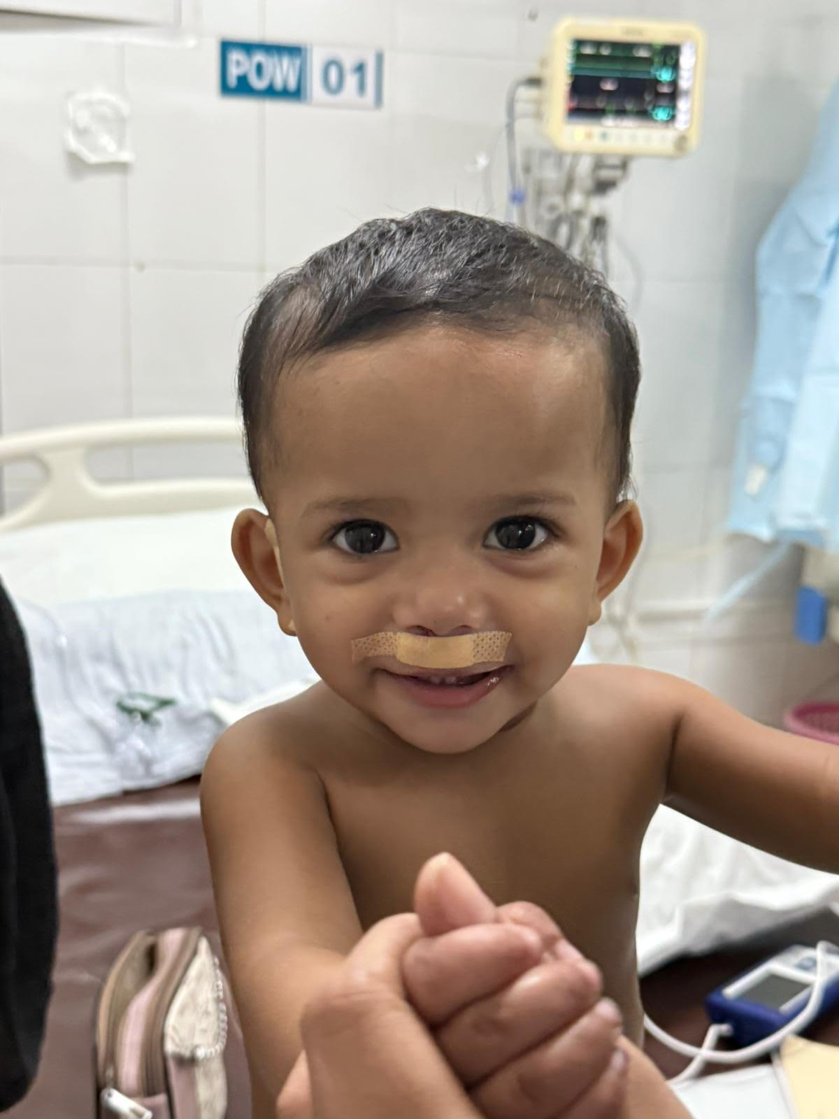 Child after successful cleft surgery
